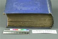 Pepys Before Treatment