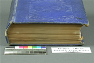 Pepys Before Treatment