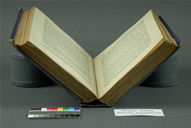 Pepys Before Treatment